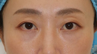 施術後